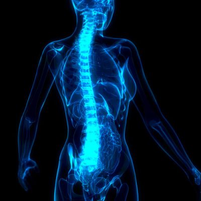 xray_scoliosis_02